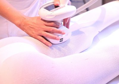 Epilation Definitive Lausanne